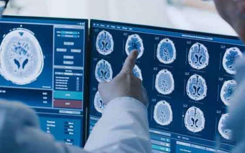 سرطانهای شایع در ایران کدامند؟