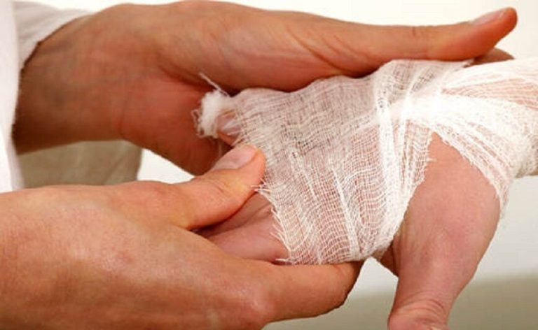 تولید زخم‌پوش نانو الیاف