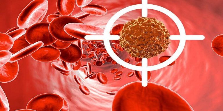 درمان سرطان سینه