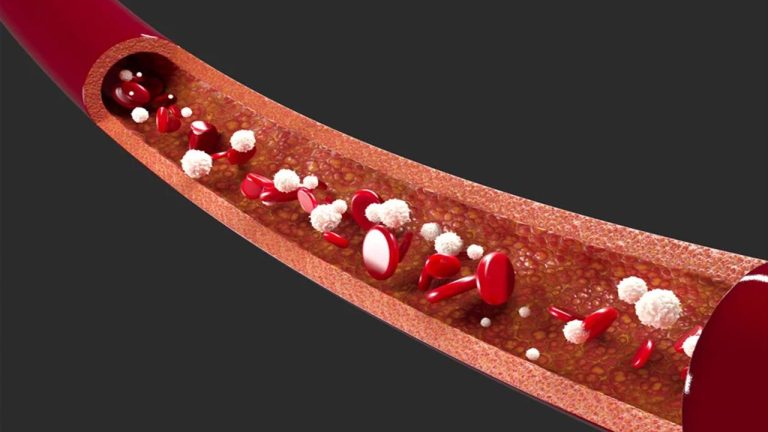 پایش لحظه‌ای غلظت دارو در خون