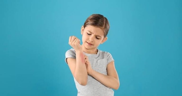 عرق سوز شدن