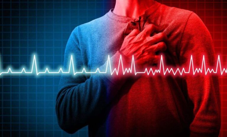 آریتمی پیچیده قلبی