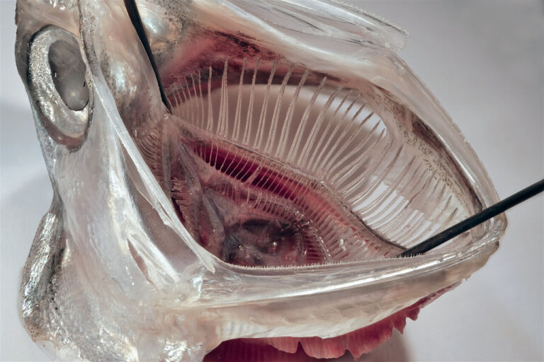 تصفیه پساب لباسشویی