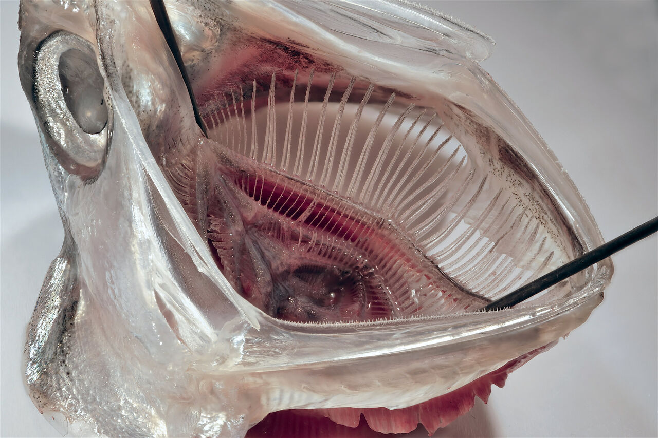 تصفیه پساب لباسشویی