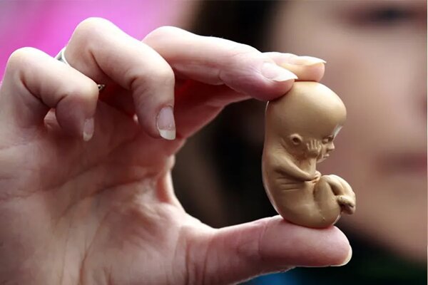 سقط‌های غیرقانونی