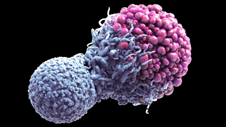 درمان سرطان