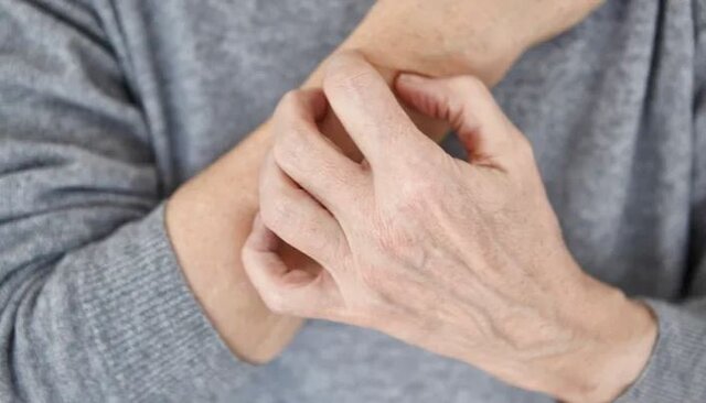 خطاهای رایج پوستی