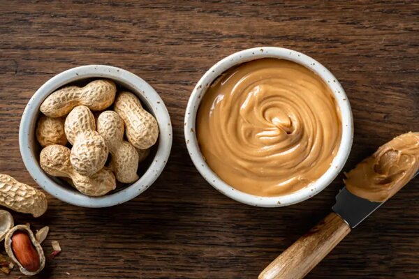 درمان آلرژی بادام‌زمینی