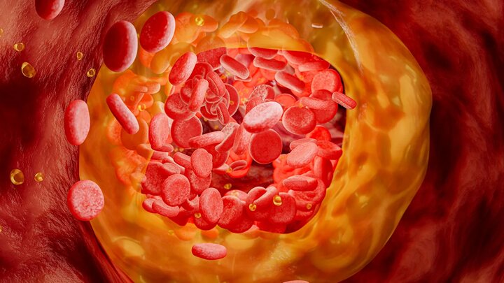 کلسترول بد