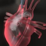 اولین جراحی رباتیک